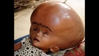 Baby Born With Alien Like Head
